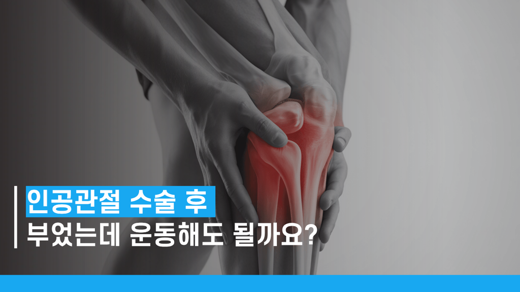 무릎인공관절수술후붓기 썸네일