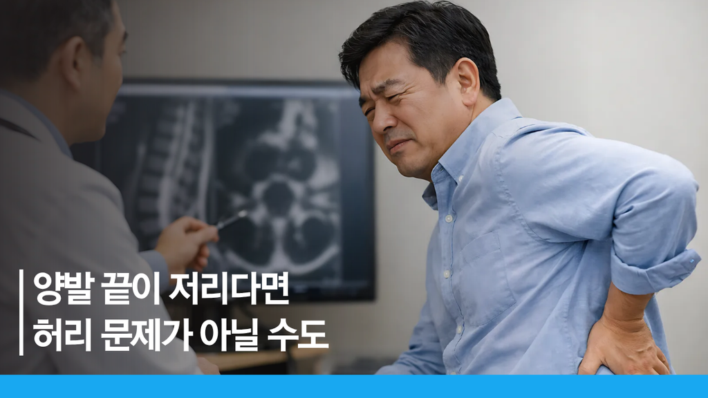 척추 신경성형술
