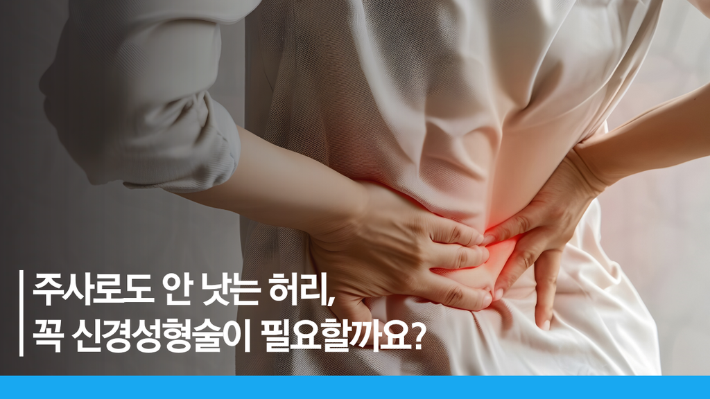 척추신경성형술 썸네일
