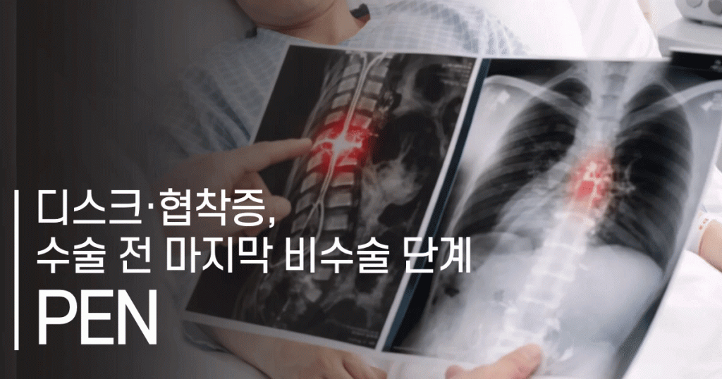 경막외강 내시경 신경성형술(PEN) 완벽 정리 | 적응증·시술 과정·주의사항