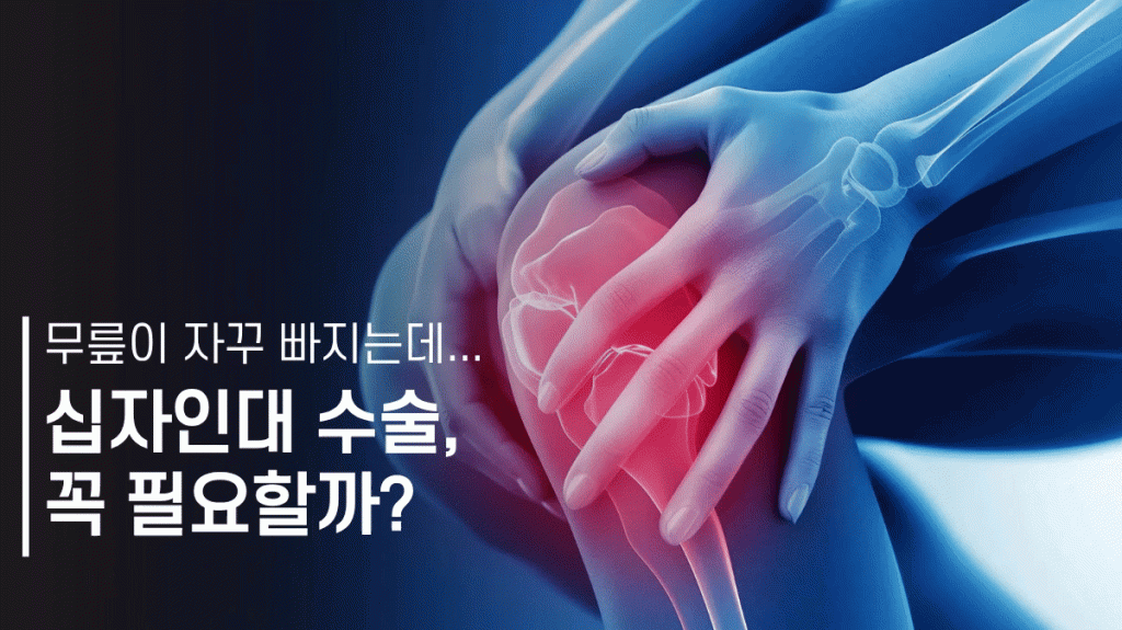 안산십자인대수술 대표이미지