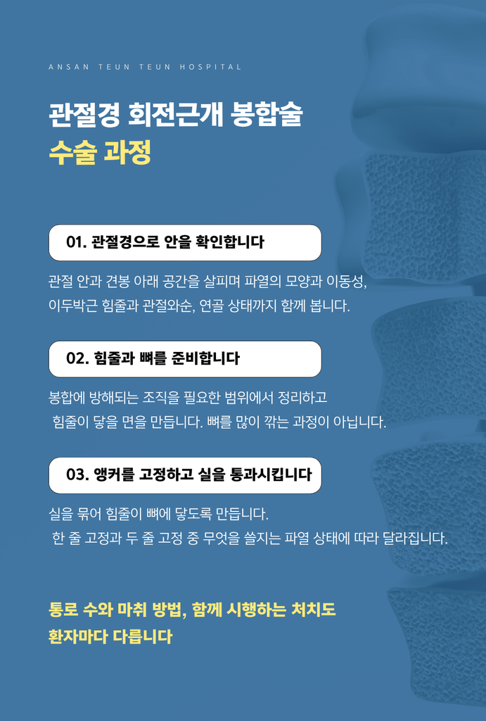 관절경 확인부터 힘줄과 뼈 준비, 앵커 봉합까지 정리한 회전근개 봉합술 과정