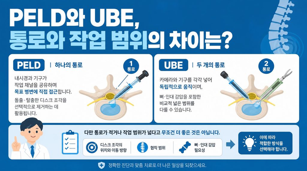 안산허리디스크 진단 방법